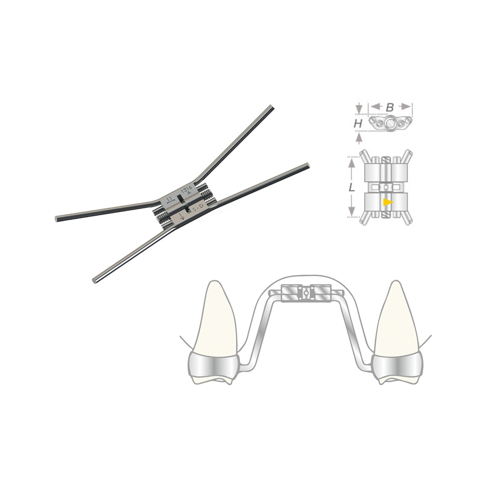 Vector 620 Gaumennahtschraube 10St