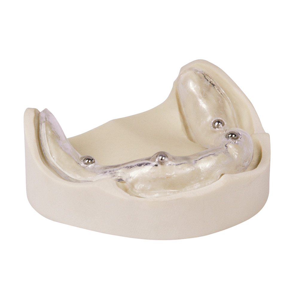 Drufoplast 120x3,0mm transparent 100St