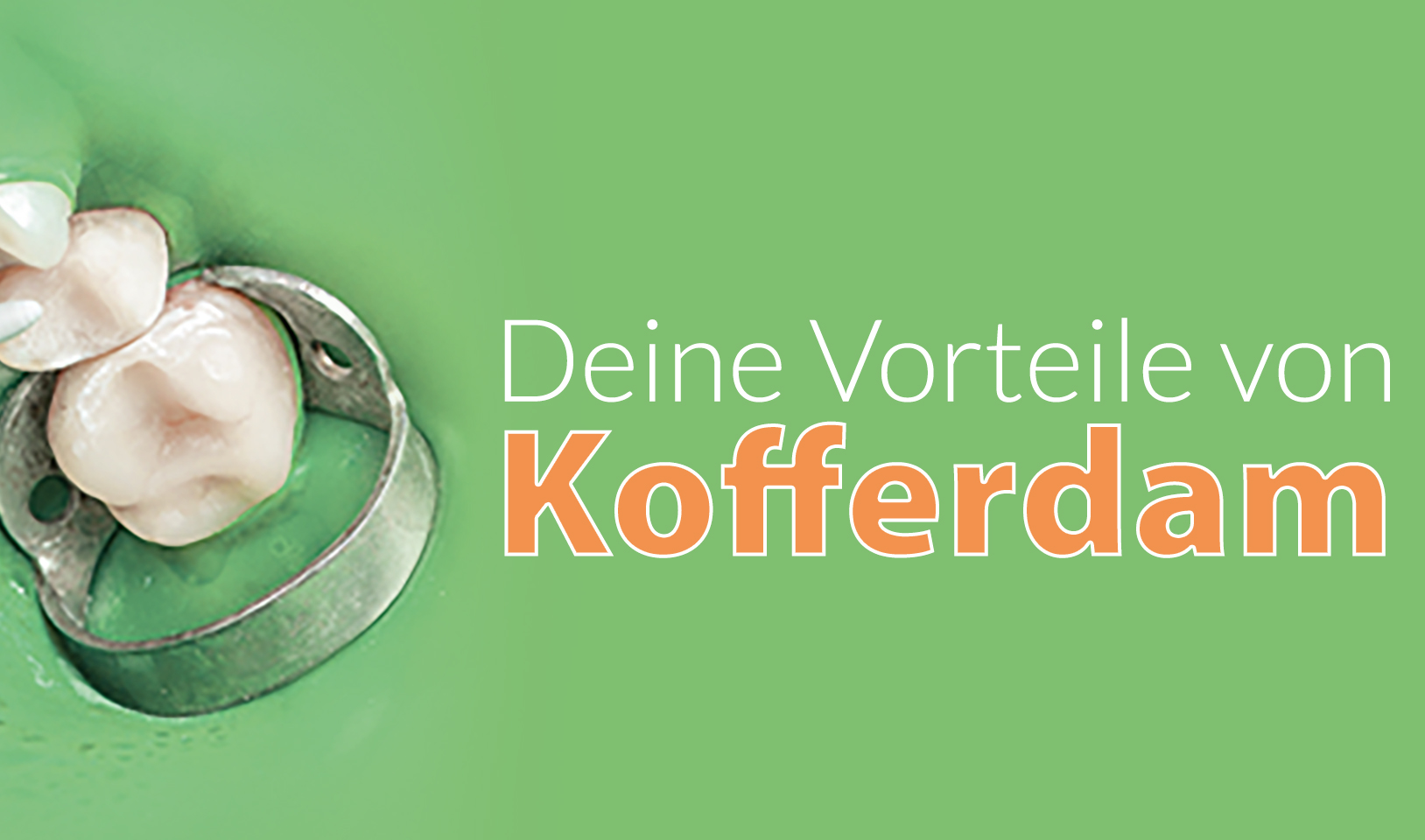 Kofferdam - Deine Vorteile