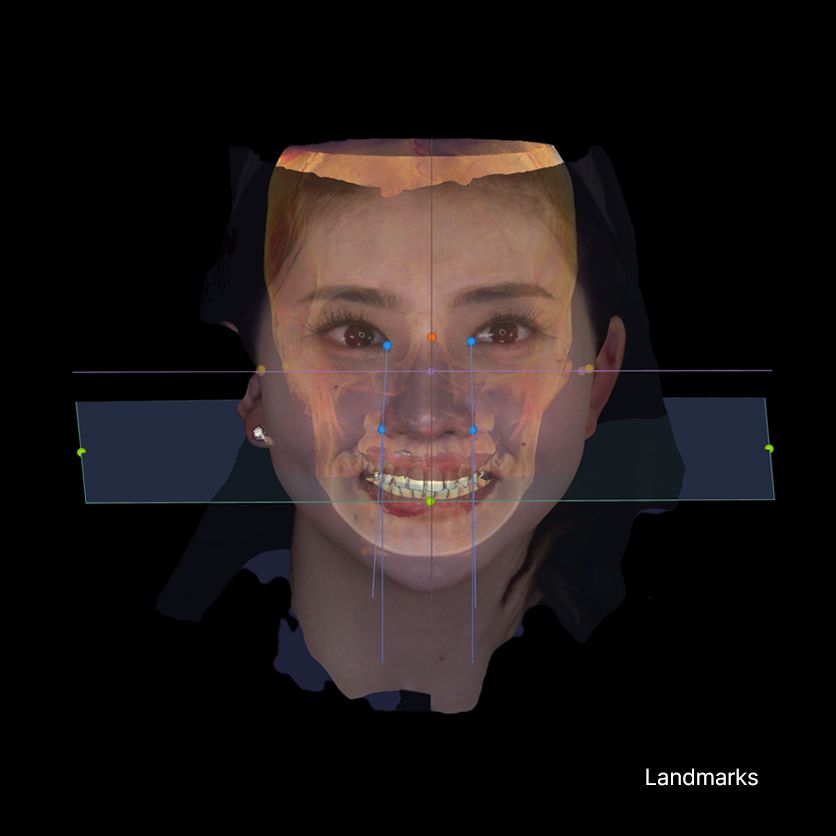 RayFace Scan Gesichtsscanner Zahnmedizin 2