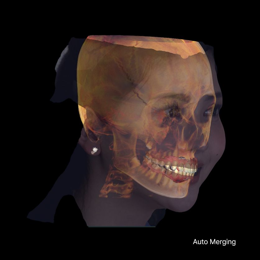 RayFace Scan Gesichtsscanner Zahnmedizin 1