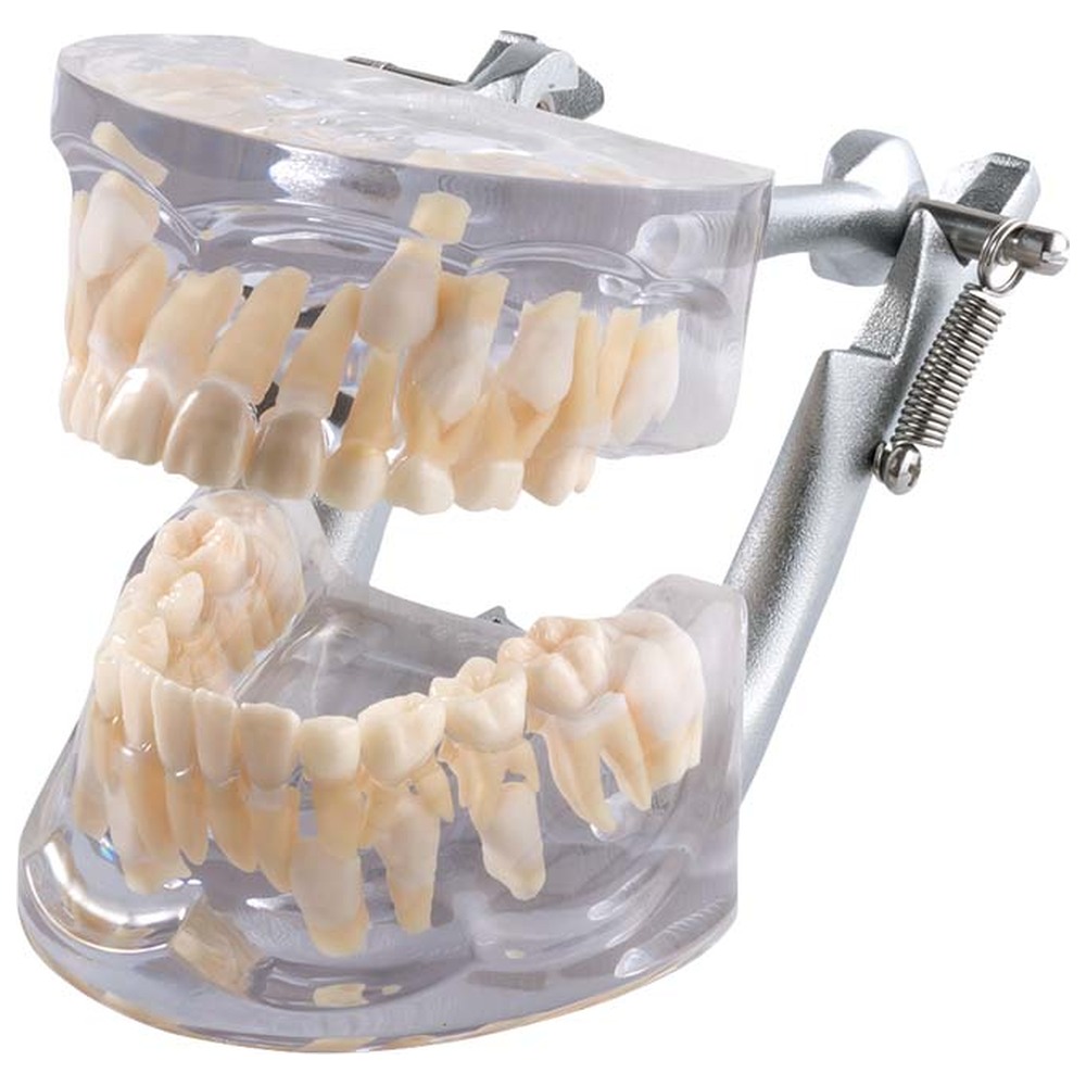Morita Wachstumsmodell transparent OK + UK P12D-100A - Stück