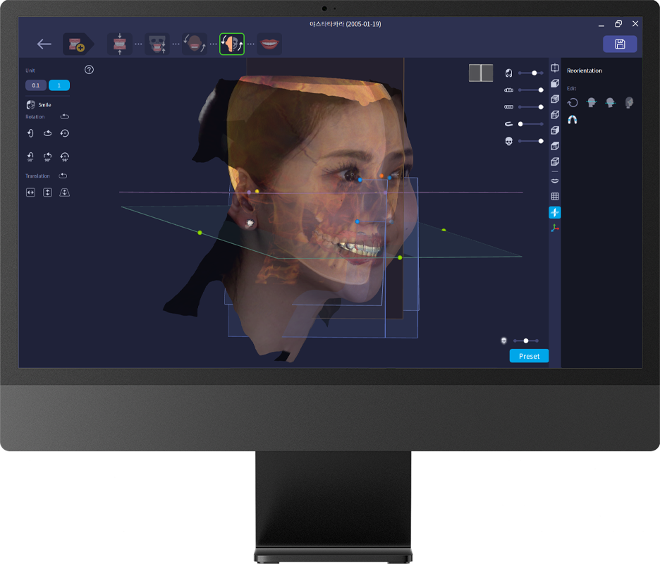 RayFace Scan Gesichtsscanner Zahnmedizin 3
