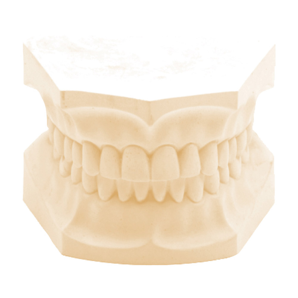 Glastone Superhartgips Tan 22,7Kg