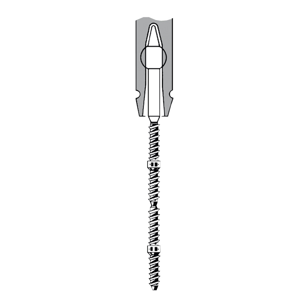 TMS Link plus Minim 2/1 Titan 24St