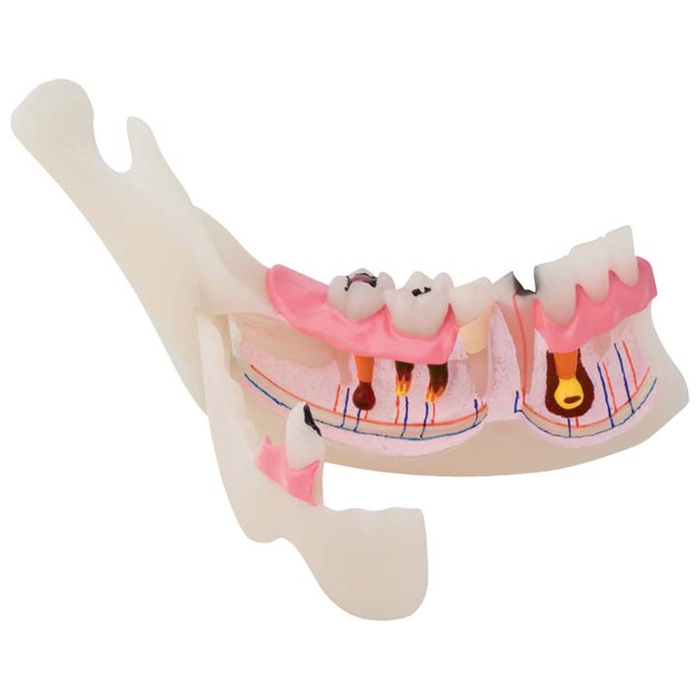 Morita Pathologisches halbes UK Modell P13-TR10 - Stück