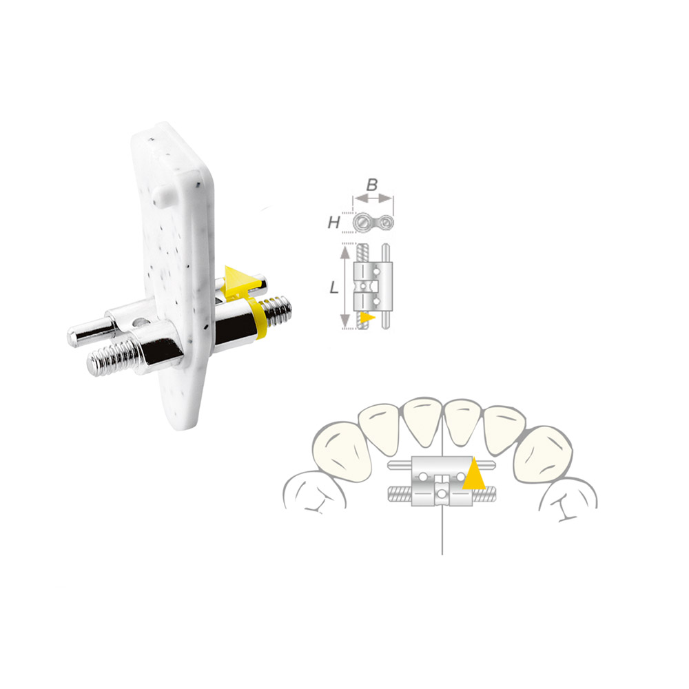 Dehnschraube Vector 080 medium 10St