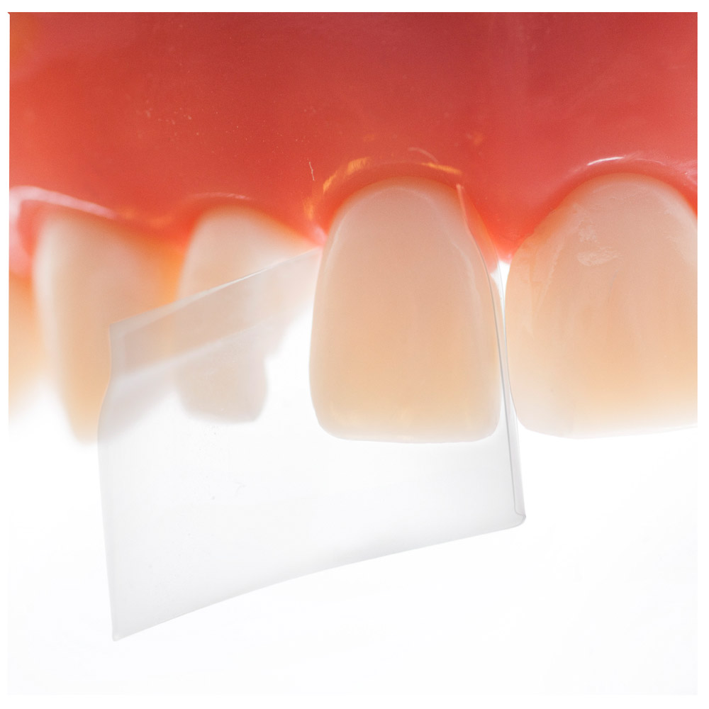 ProxyPal 3D Matrix 36St