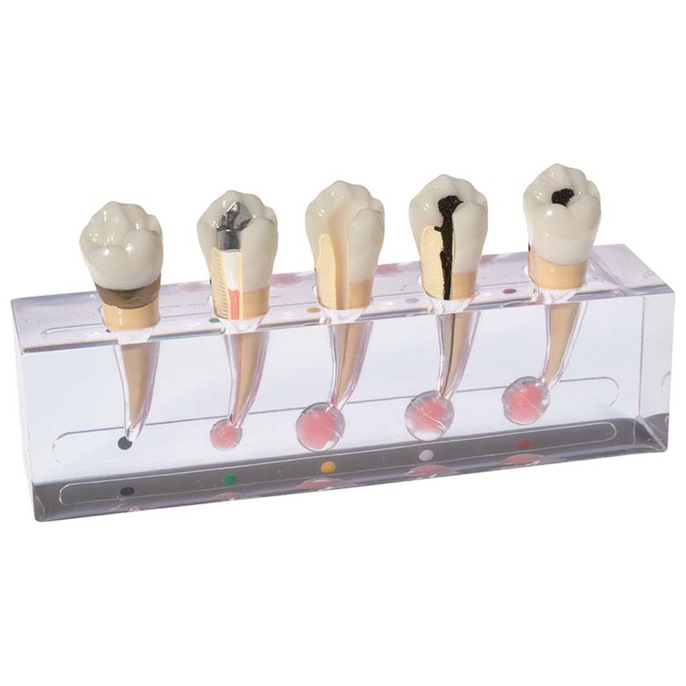 Morita Endodontiemodell „Granulom“ P23-END.2 - Stück