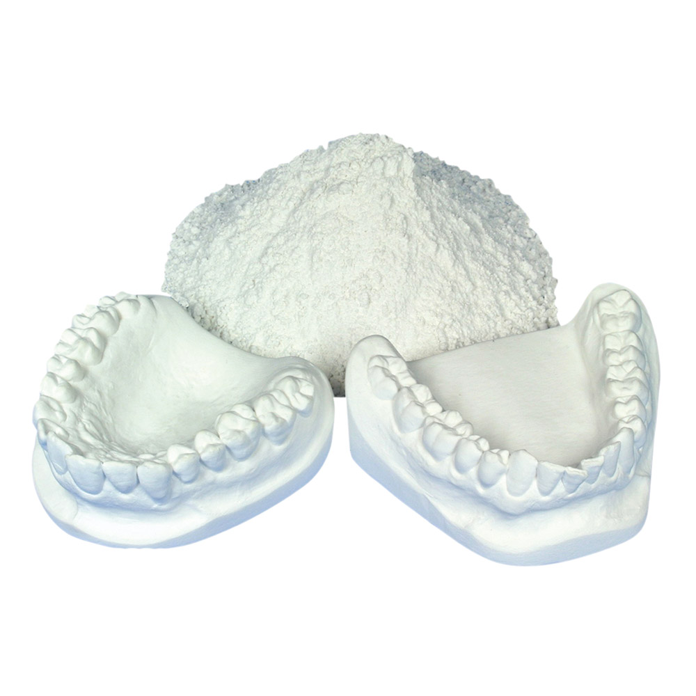 Alabastergips NPU 10Kg Eimer