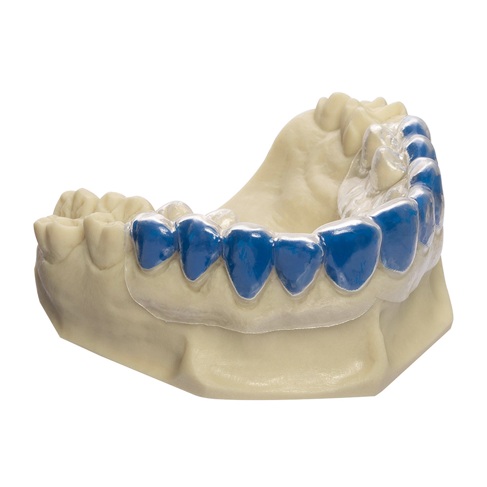 Drufolen W 0,65x125mm blau 40St